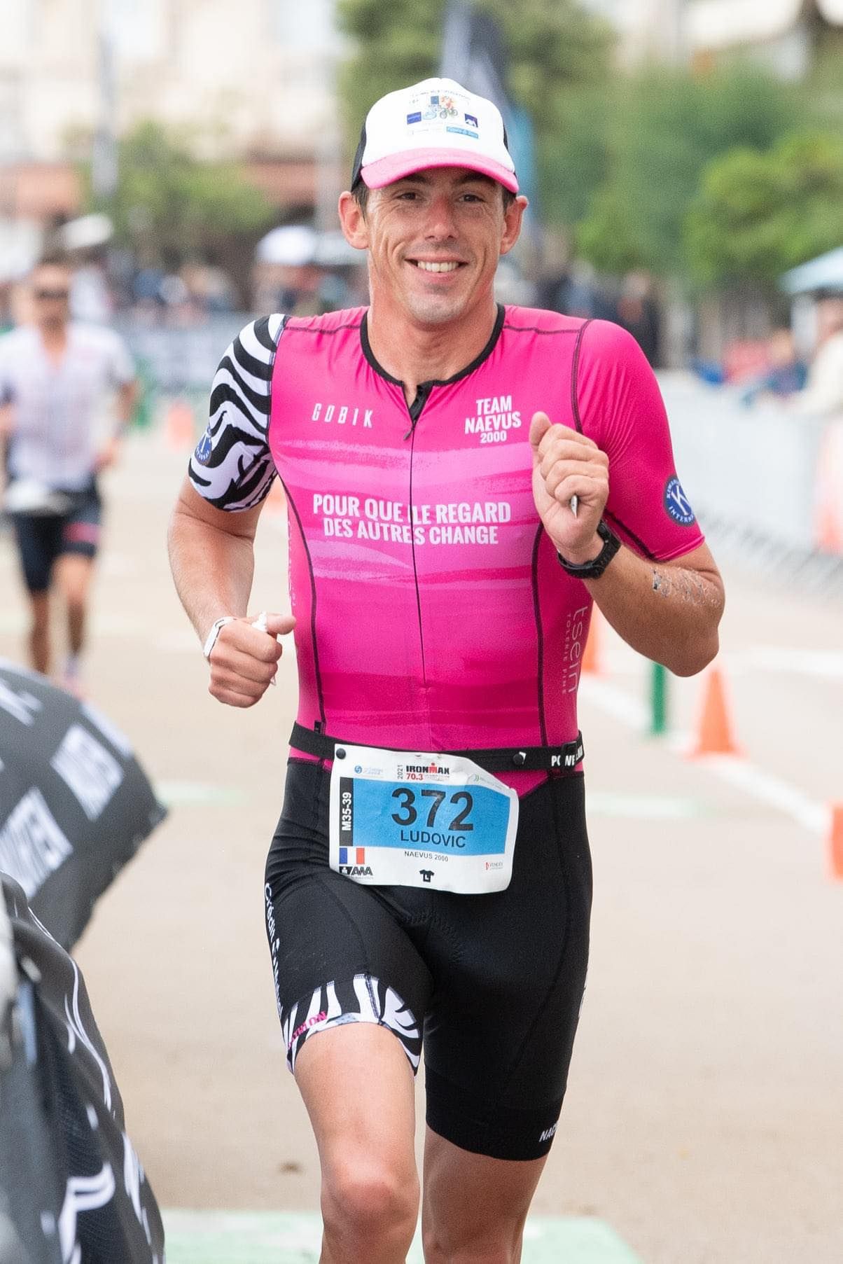 Naevus géant : association naevus 2000