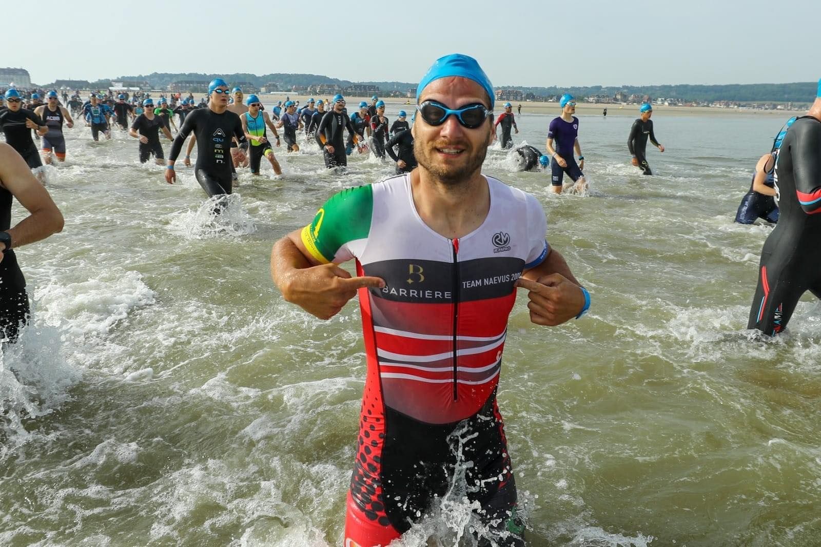 Naevus géant : association naevus 2000