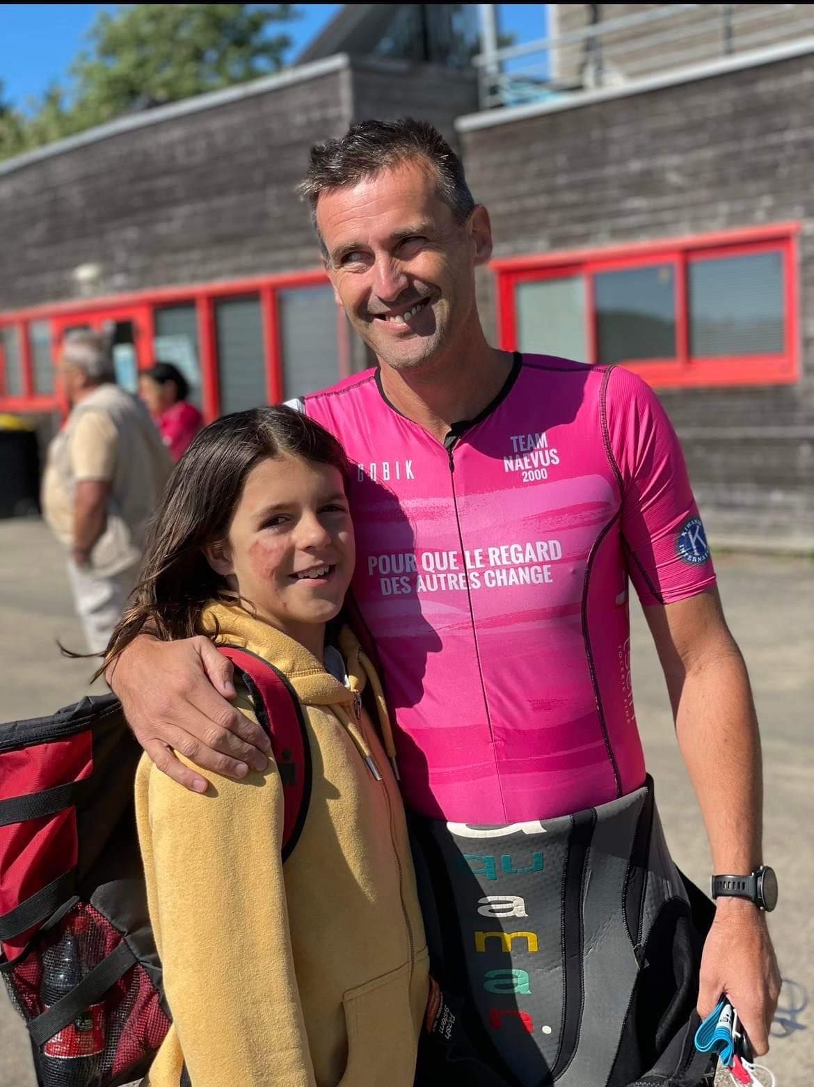 Naevus géant : association naevus 2000